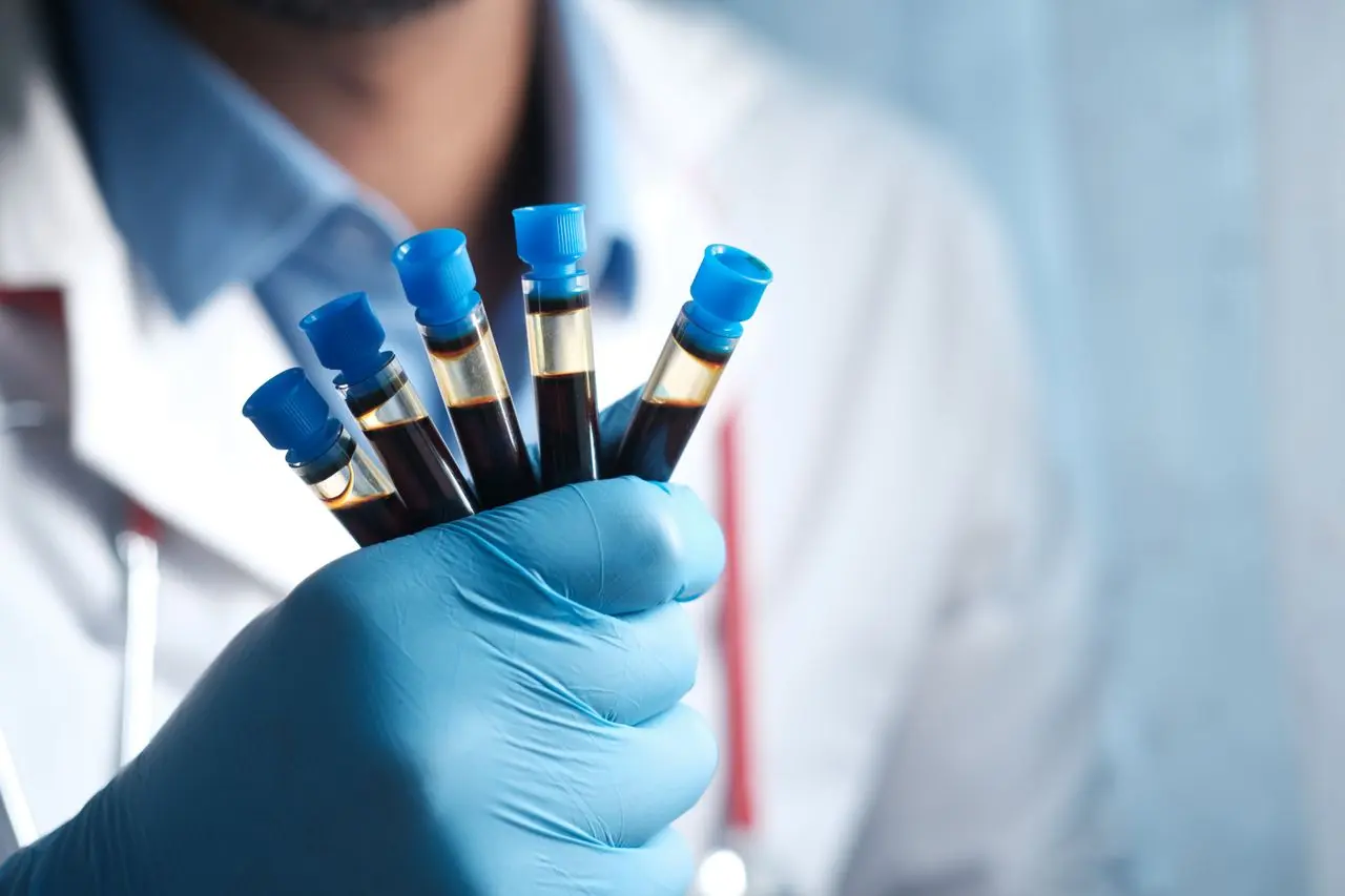 Low Bilirubin: What It Means and Whether It Matters
