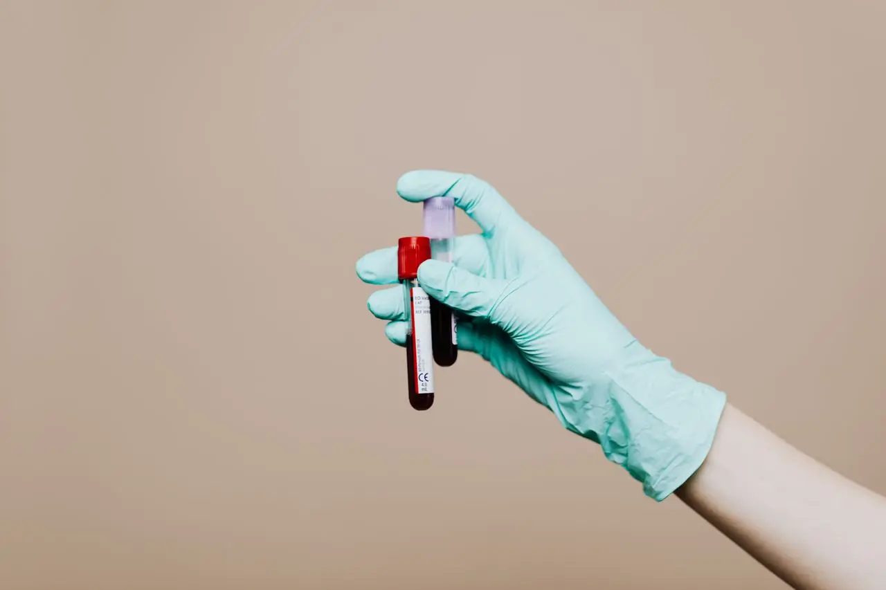 Low vs High Alkaline Phosphatase: Causes and How to Address