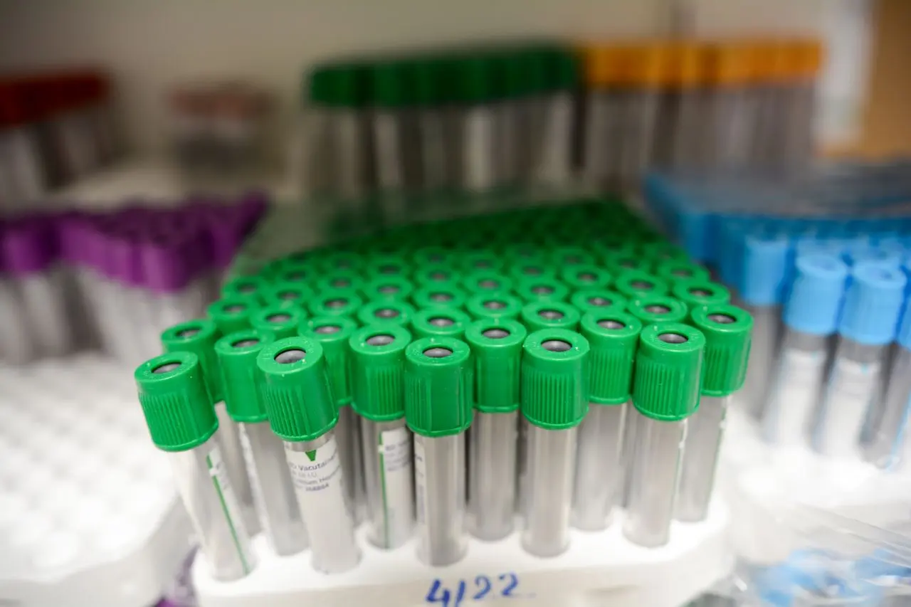 What Is Considered a High LDH Level? Causes, Questions, and What to Do Next