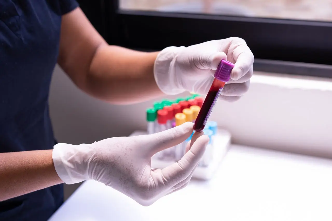 High Lymphocytes: What Your Results Mean