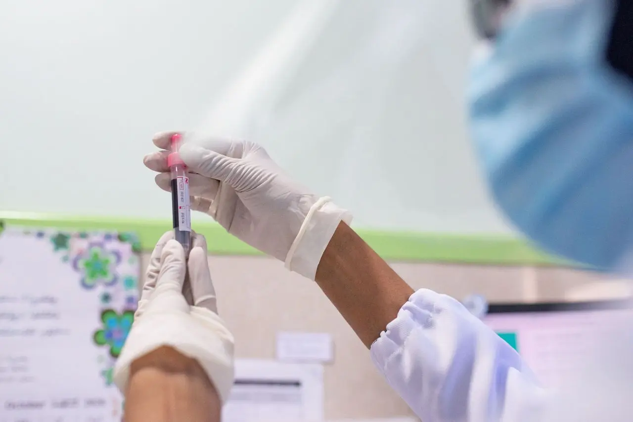 High MPV Blood Test: What Elevated Platelet Volume Means