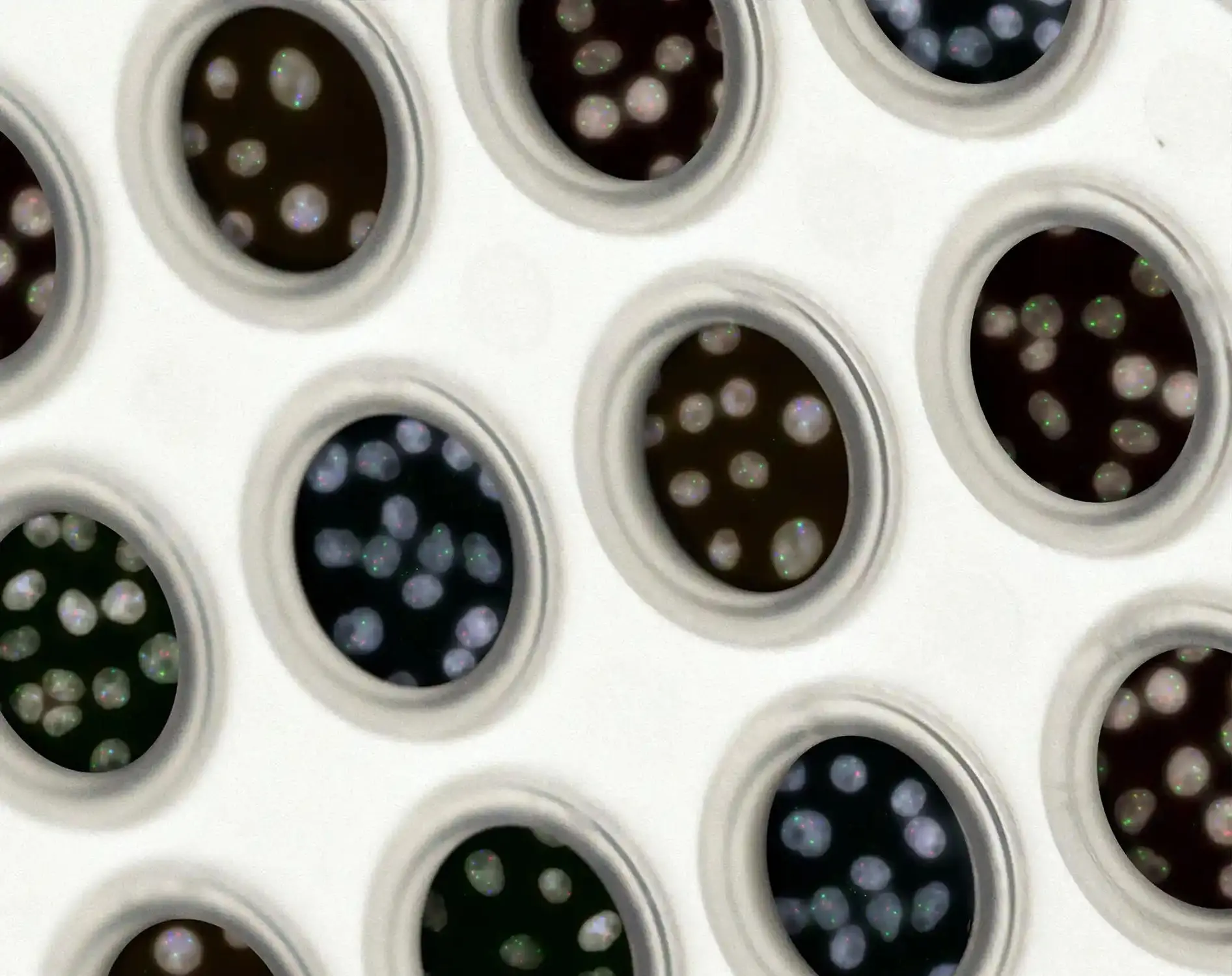 MTHFR Gene Mutation: Symptoms, Testing, and 6 Natural Treatments Options