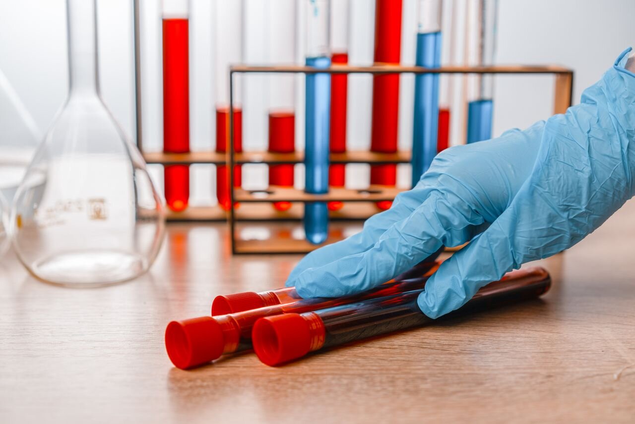 How To Read Your Bloodwork Like a Longevity Doctor | Parsley Health