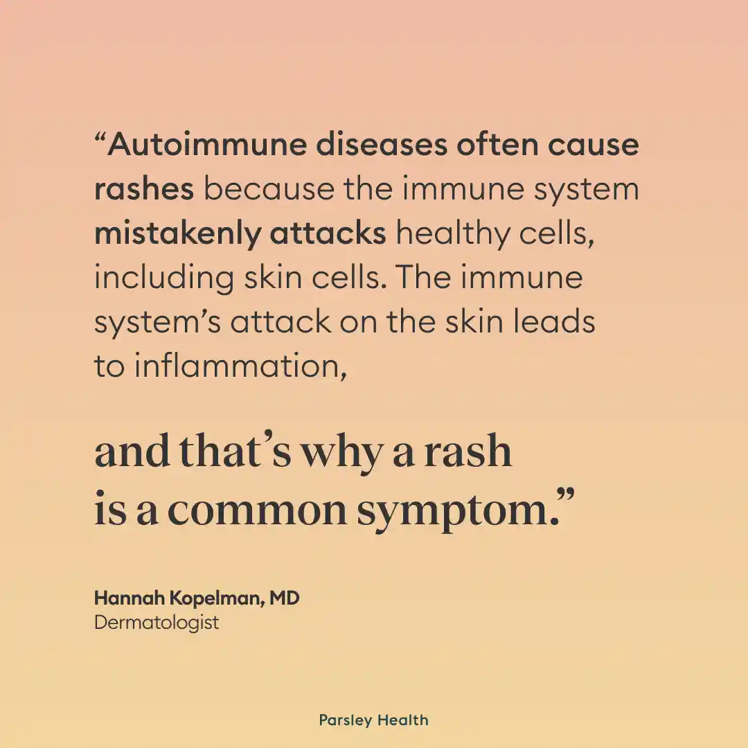 Autoimmune Rash: Types, Causes, and Treatment Options | Parsley Health